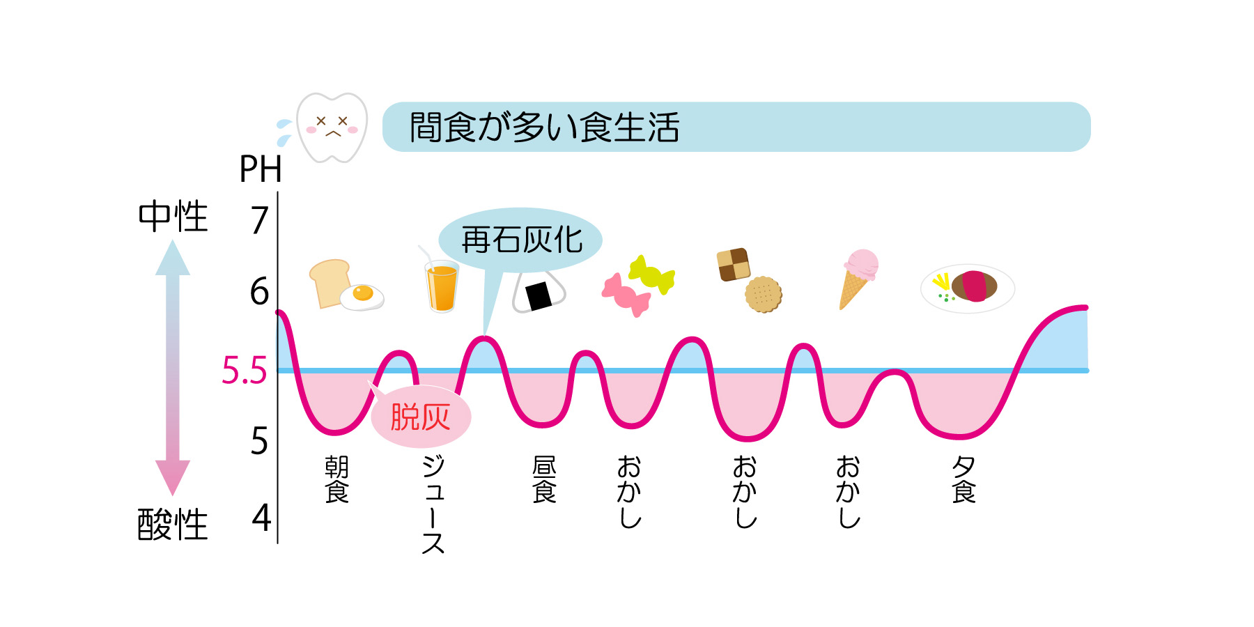 子供の虫歯について